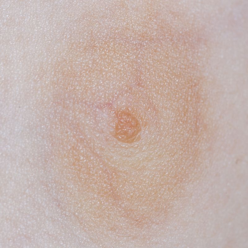 © Berglind Rögnvaldsdóttir - Image from the Uncensored photography project