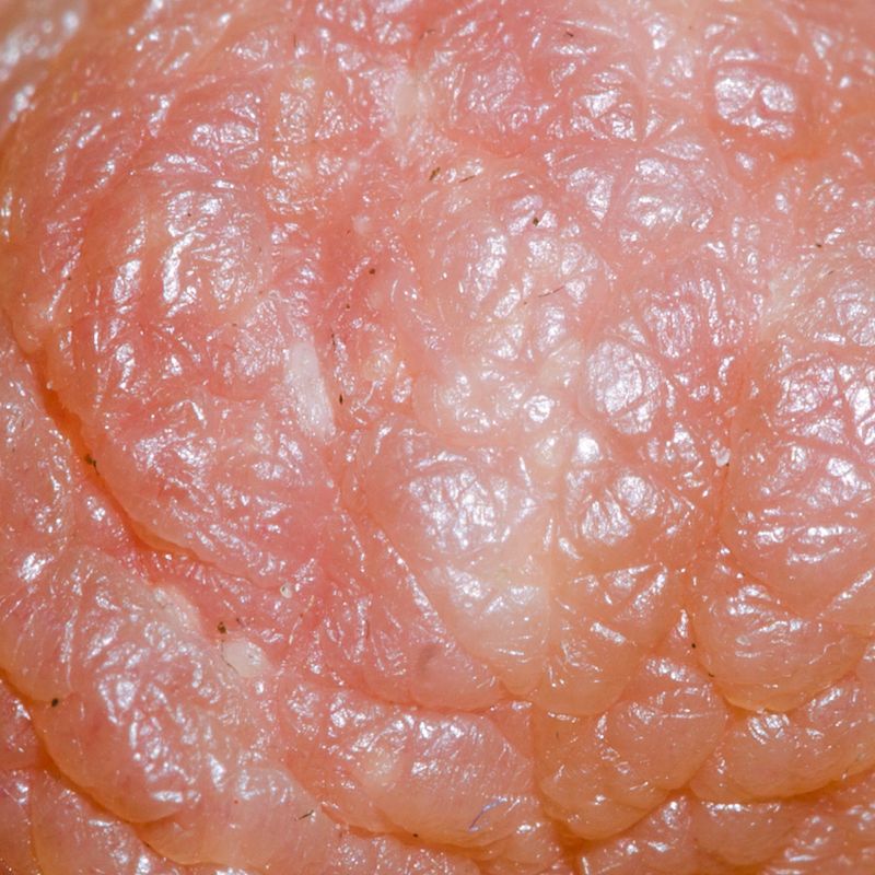 © Berglind Rögnvaldsdóttir - Image from the Uncensored photography project