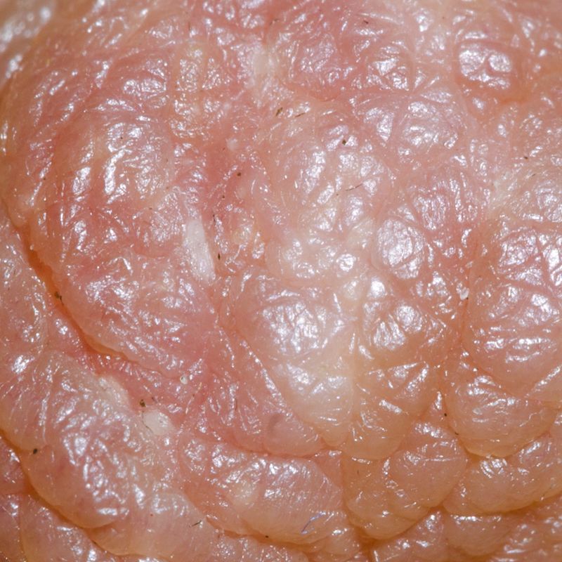 © Berglind Rögnvaldsdóttir - Image from the Uncensored photography project