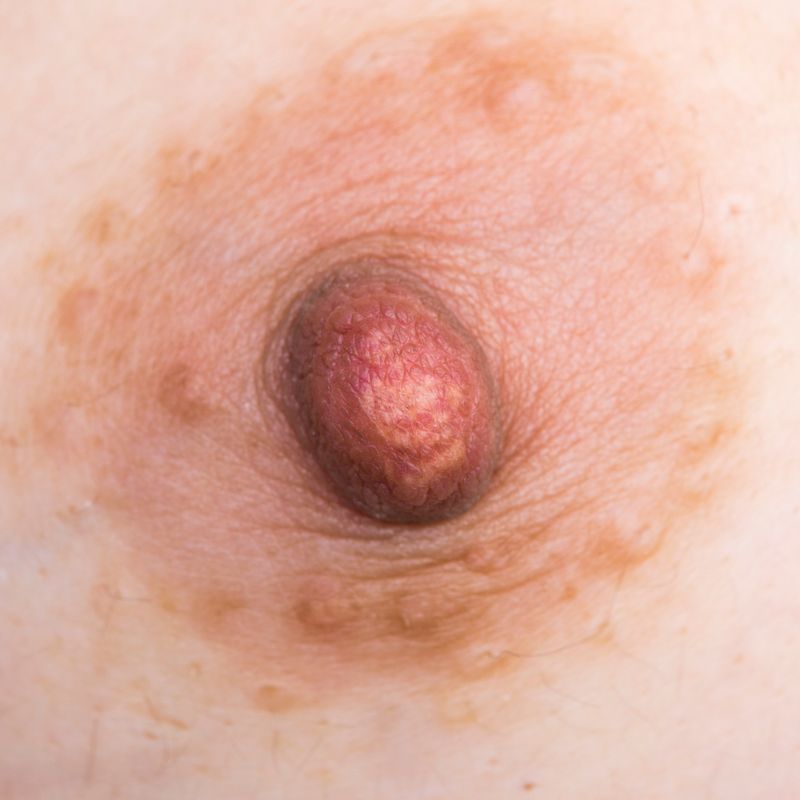 © Berglind Rögnvaldsdóttir - Image from the Uncensored photography project