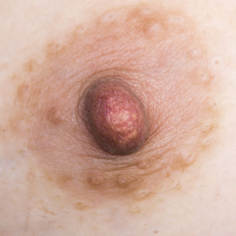 © Berglind Rögnvaldsdóttir - Image from the Uncensored photography project