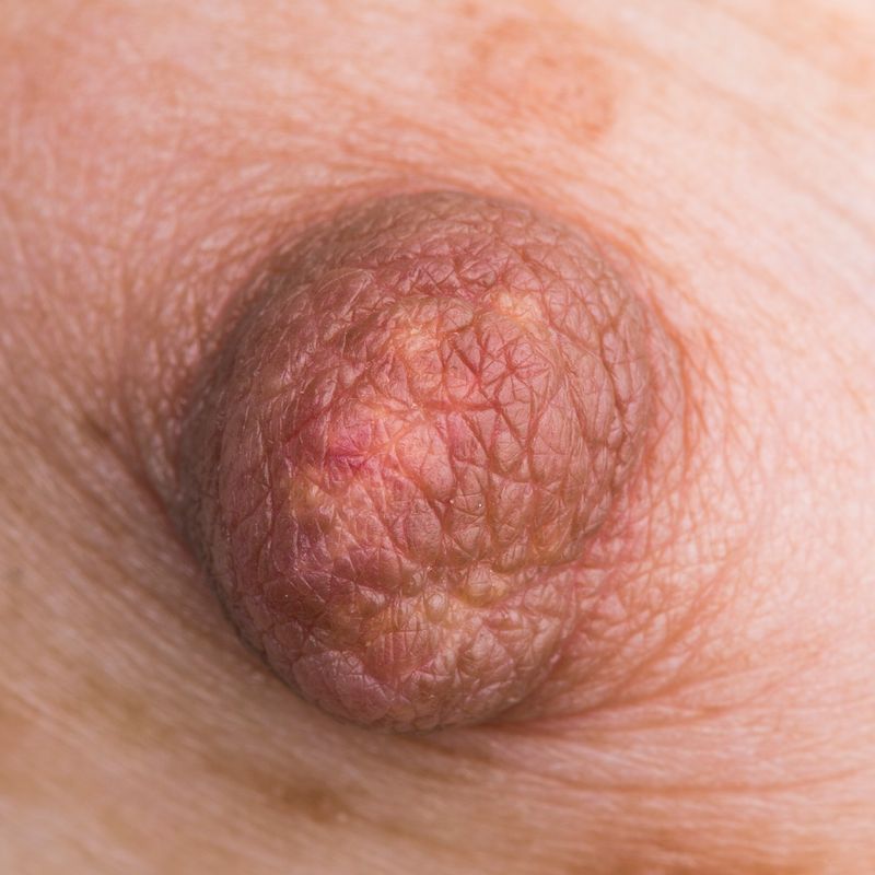 © Berglind Rögnvaldsdóttir - Image from the Uncensored photography project