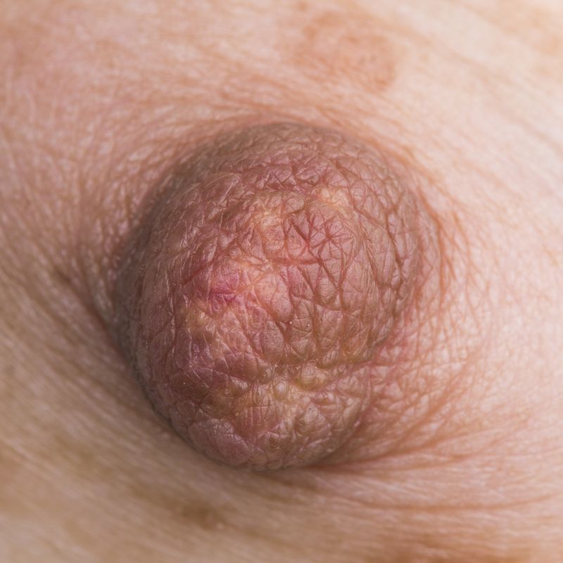 © Berglind Rögnvaldsdóttir - Image from the Uncensored photography project