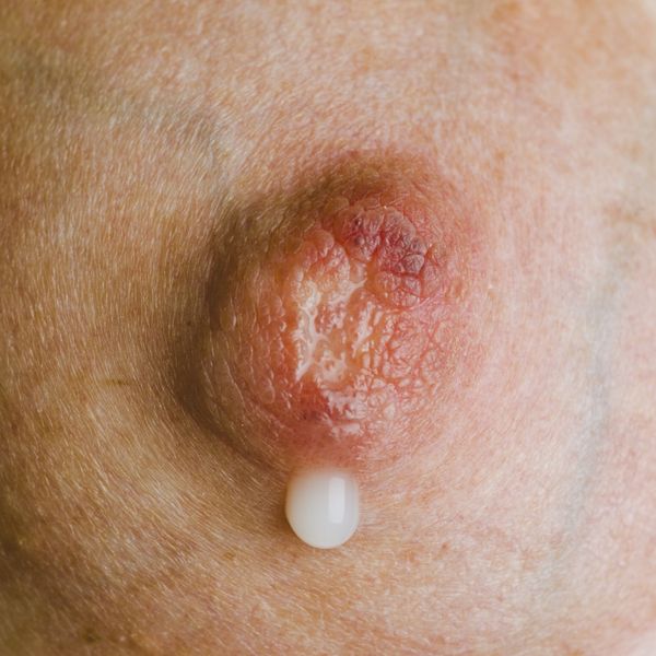 © Berglind Rögnvaldsdóttir - Image from the Uncensored photography project