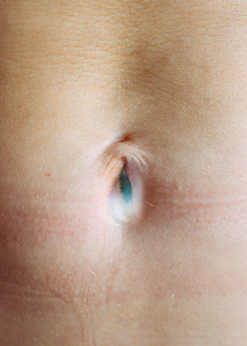 © Berglind Rögnvaldsdóttir - seeing