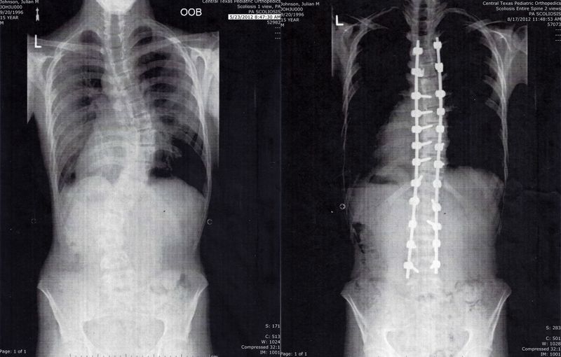 © Julian Johnson - Image from the Even You, Metal Back photography project