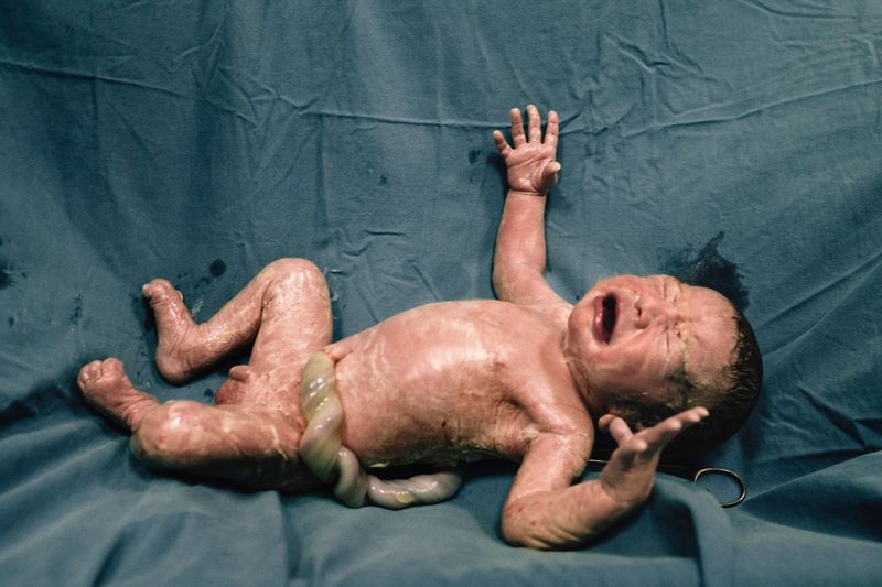 © Cemre Yeşil - Image from the DOUBLE PORTRAIT photography project