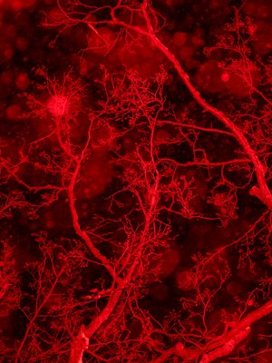 Shallow Waters, Misty Waves