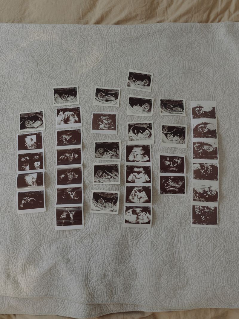 © Kristina Varaksina - Image from the Dream Children – Battling Infertility photography project