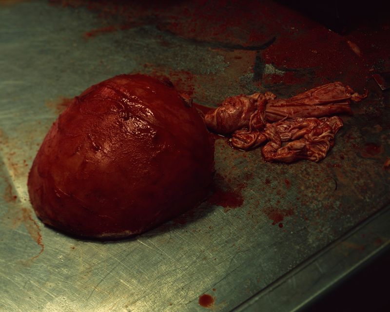 © Grzegorz Wełnicki - Element of a human.