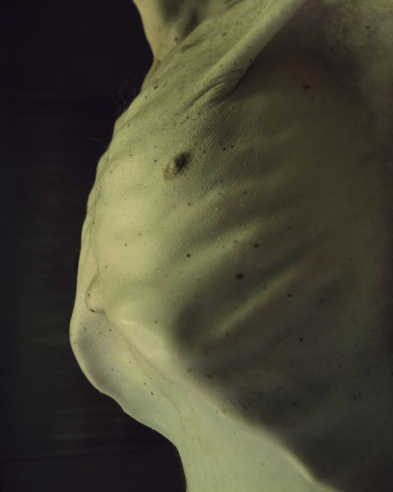 © Grzegorz Wełnicki - Deceased human body.