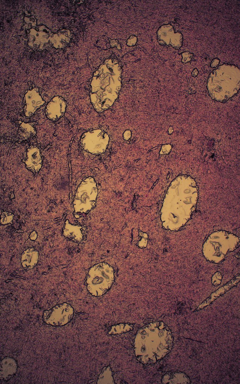© Grzegorz Wełnicki - Microscopic image of a pancreatic flake printed with bioink.