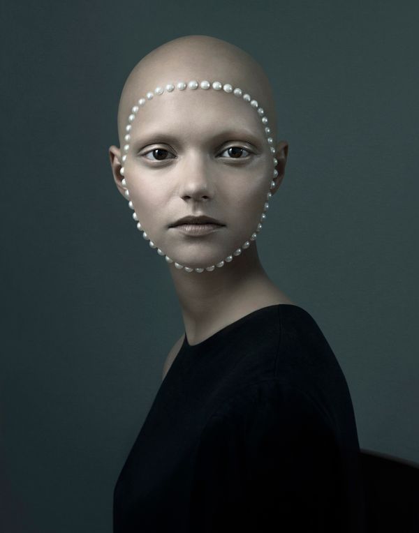 © Justine Tjallinks - Sandra - Alopecia