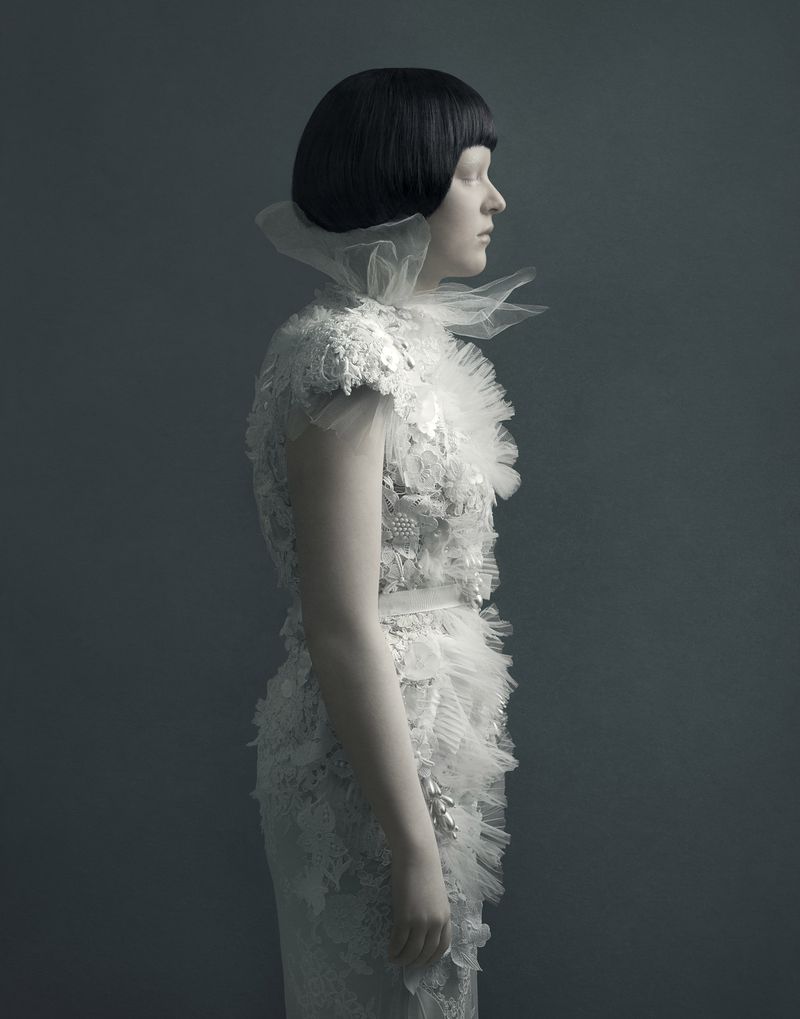 © Justine Tjallinks - Anke - Albinism