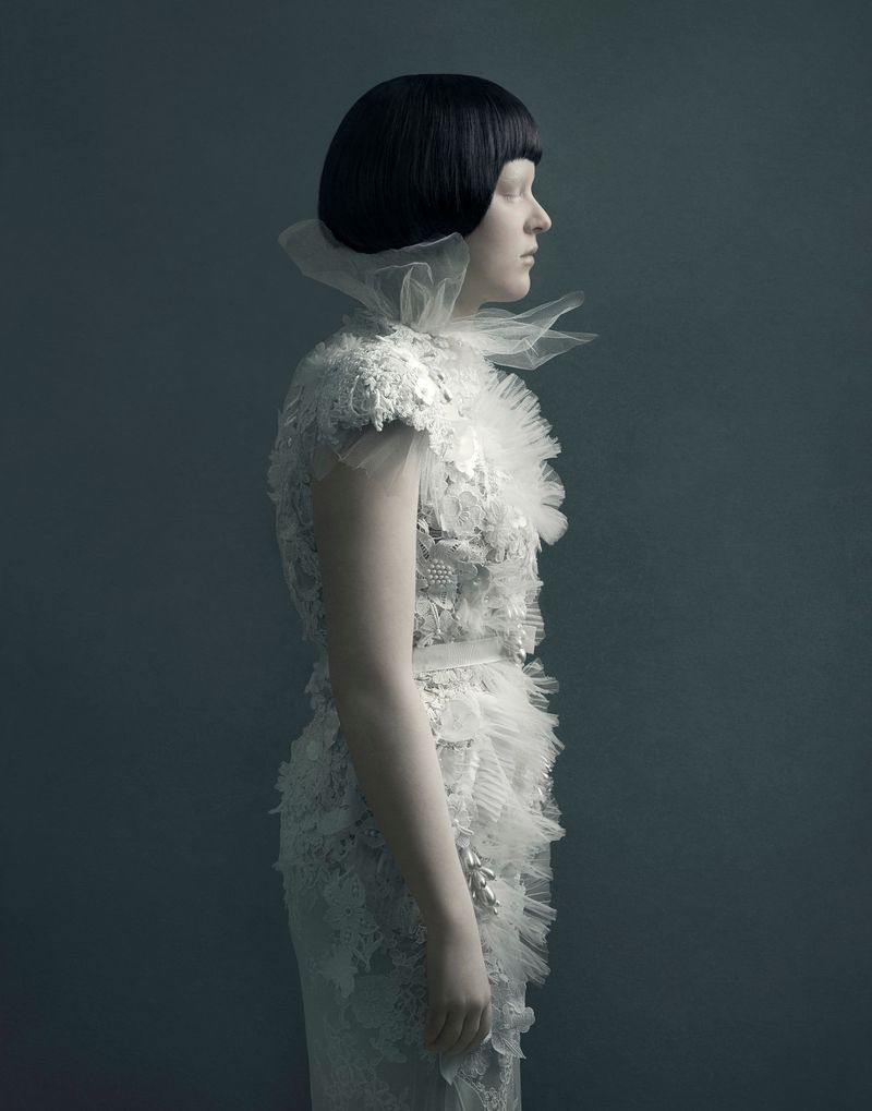 © Justine Tjallinks - Anke - Albinism