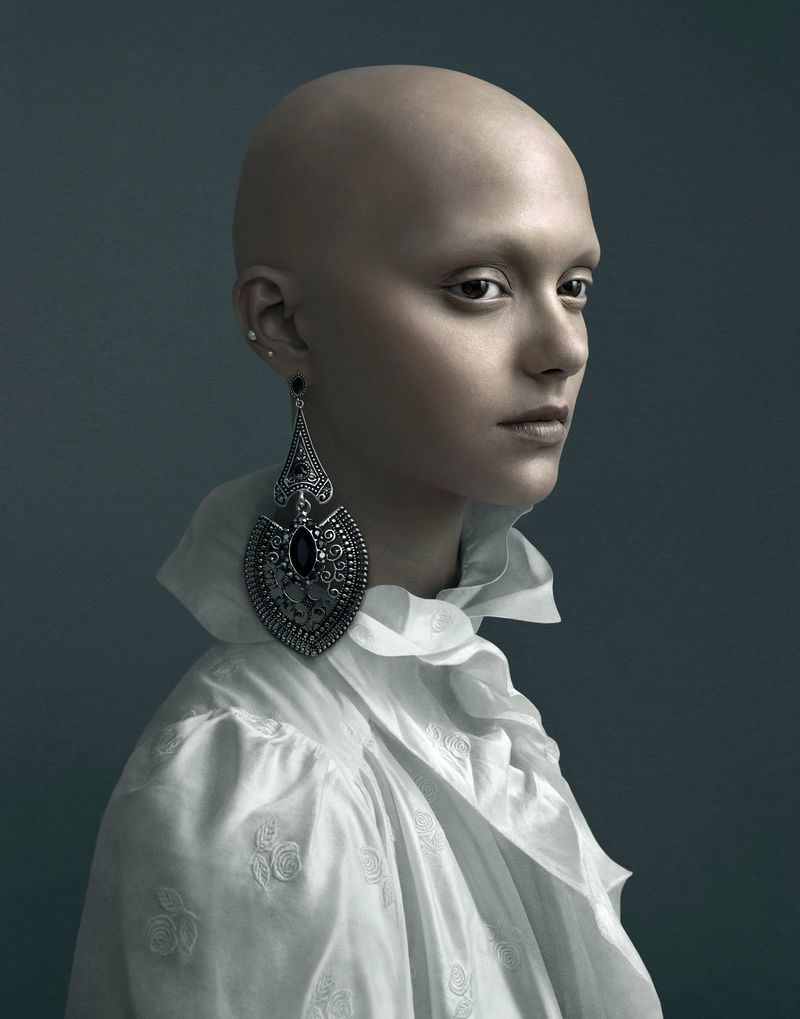 © Justine Tjallinks - Sandra - Alopecia