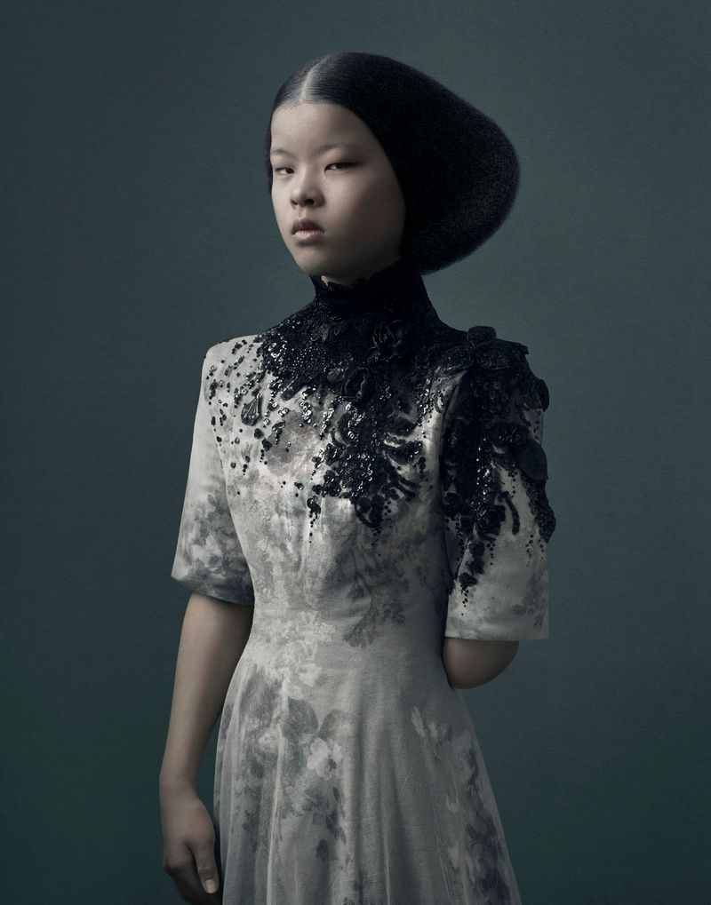 © Justine Tjallinks - Suu LiHong - Amputee