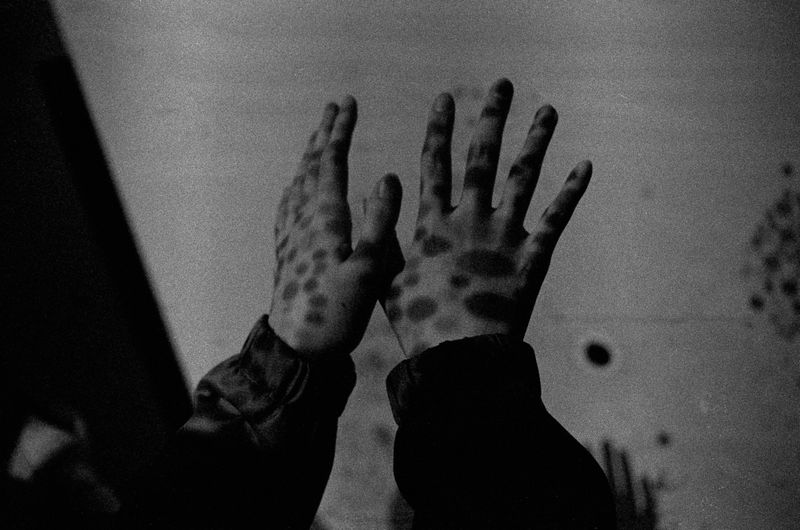 © jieyu deng - Image from the Pain No More photography project