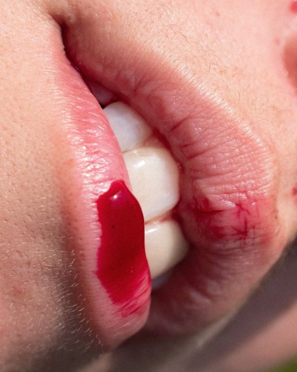 Image from a project on PhMuseum