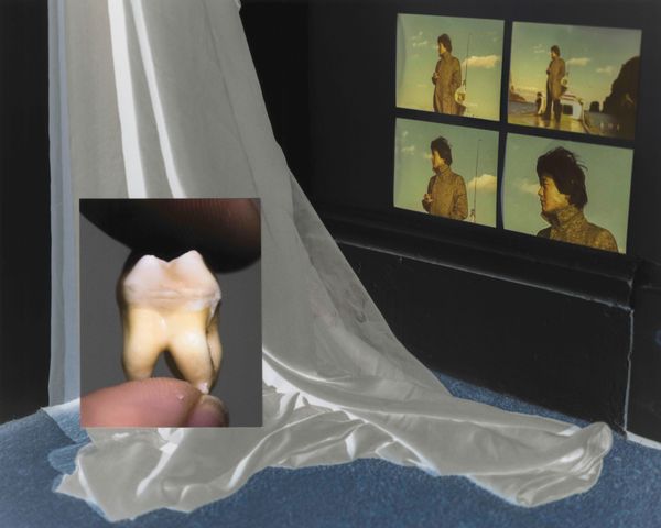 © Hankyung Ryu - 03 My Room and My Molar