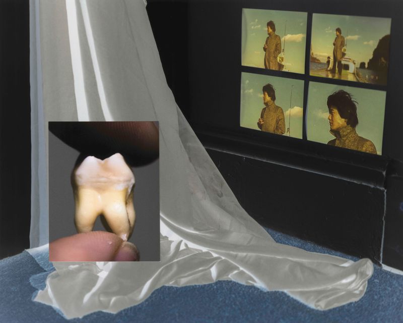 © Hankyung Ryu - 03 My Room and My Molar