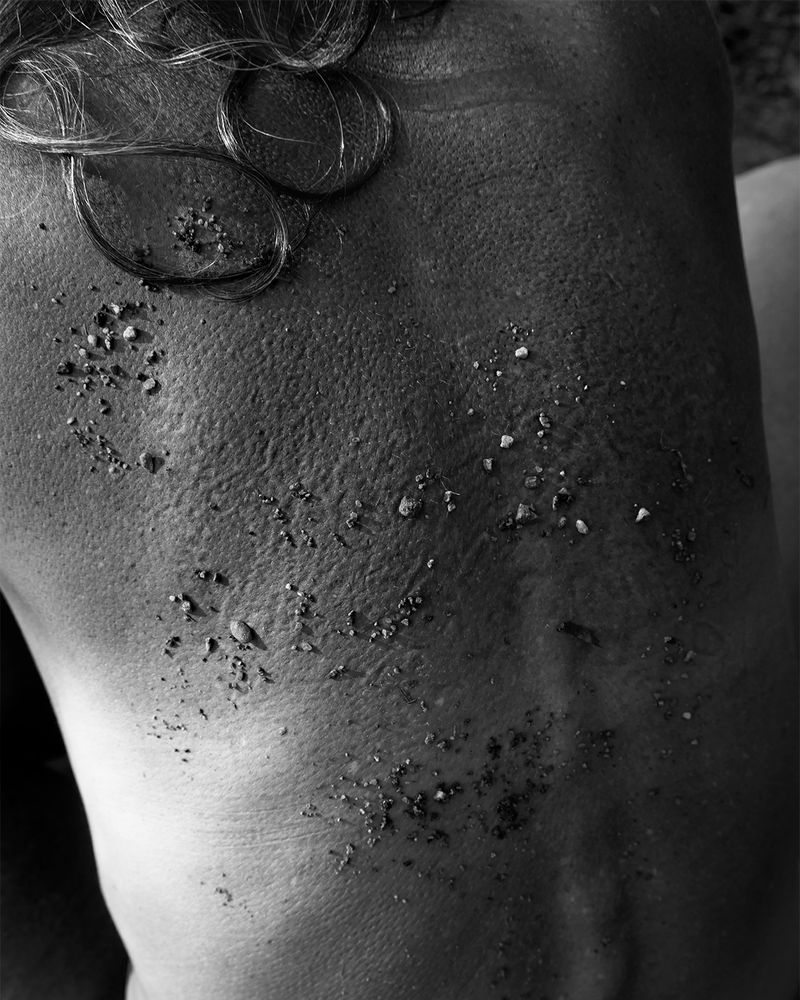 © Jillian Freyer - Small rocks are stuck in the woman's back, leaving impressions.