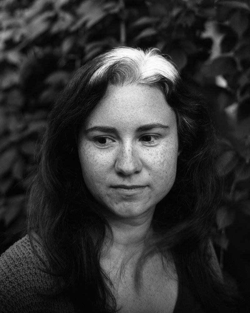 © Jillian Freyer - Amanda has been going gray since she was a little girl -- here you can see her white hair growing in.