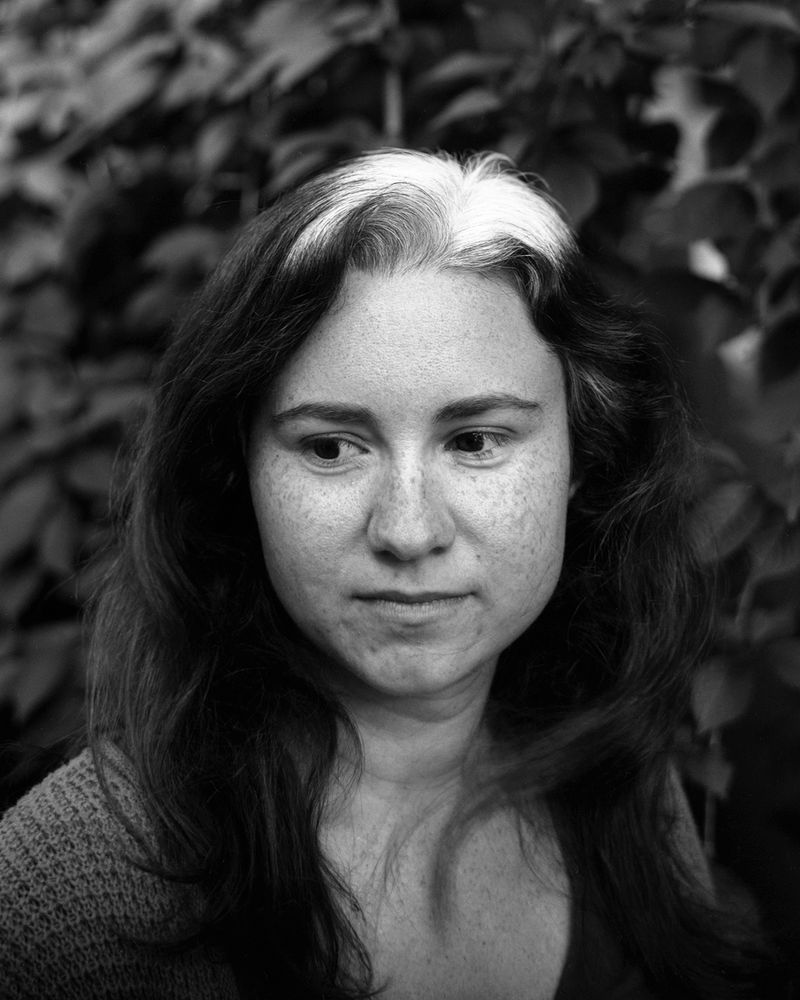 © Jillian Freyer - Amanda has been going gray since she was a little girl -- here you can see her white hair growing in.