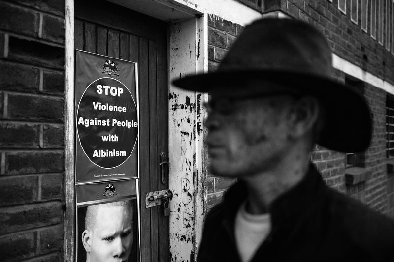 © Daniel Rodrigues - Image from the The hunted - albinos photography project