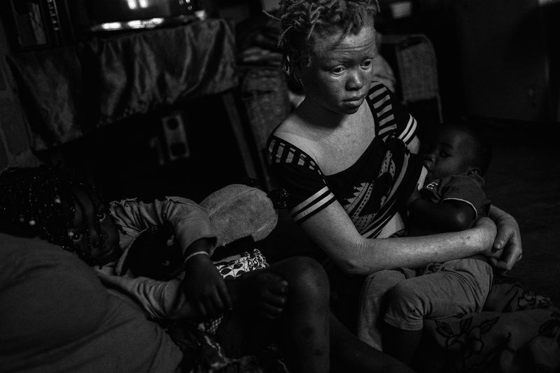 © Daniel Rodrigues - Image from the The hunted - albinos photography project