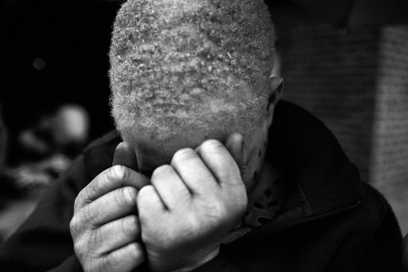 © Daniel Rodrigues - Image from the The hunted - albinos photography project