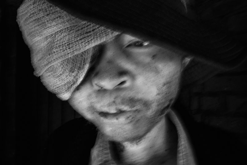 © Daniel Rodrigues - Image from the The hunted - albinos photography project