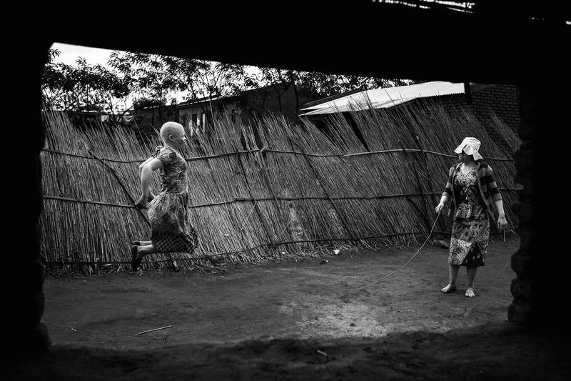 © Daniel Rodrigues - Image from the The hunted - albinos photography project