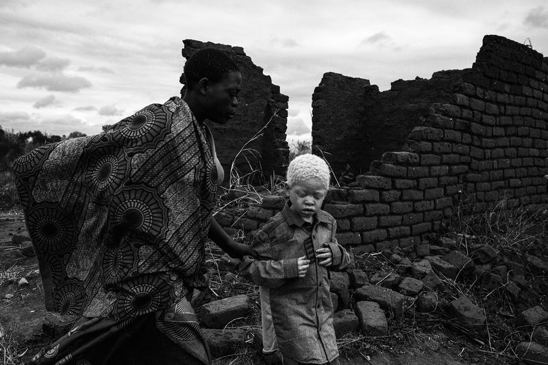 © Daniel Rodrigues - Image from the The hunted - albinos photography project