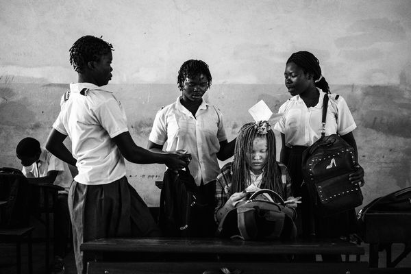 © Daniel Rodrigues - Image from the The hunted - albinos photography project