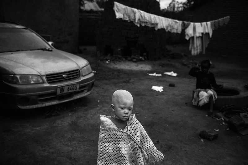 © Daniel Rodrigues - Image from the The hunted - albinos photography project