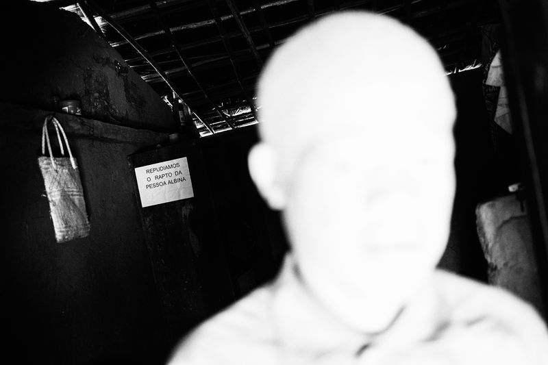 © Daniel Rodrigues - Image from the The hunted - albinos photography project