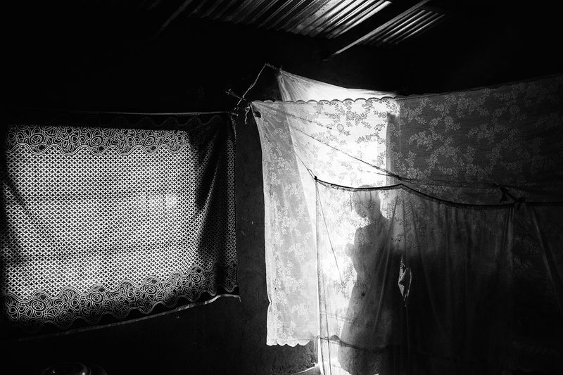 © Daniel Rodrigues - Image from the The hunted - albinos photography project