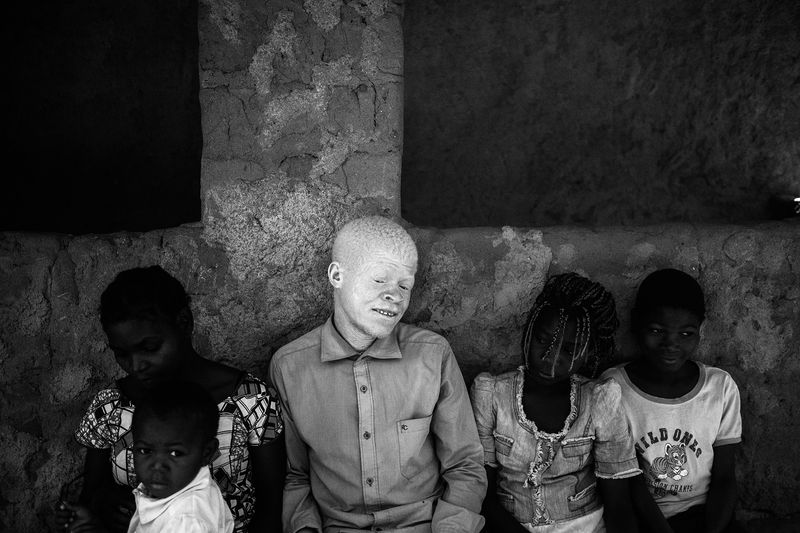 © Daniel Rodrigues - Image from the The hunted - albinos photography project