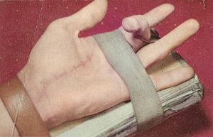 Reconstructions As Fundamental Methods