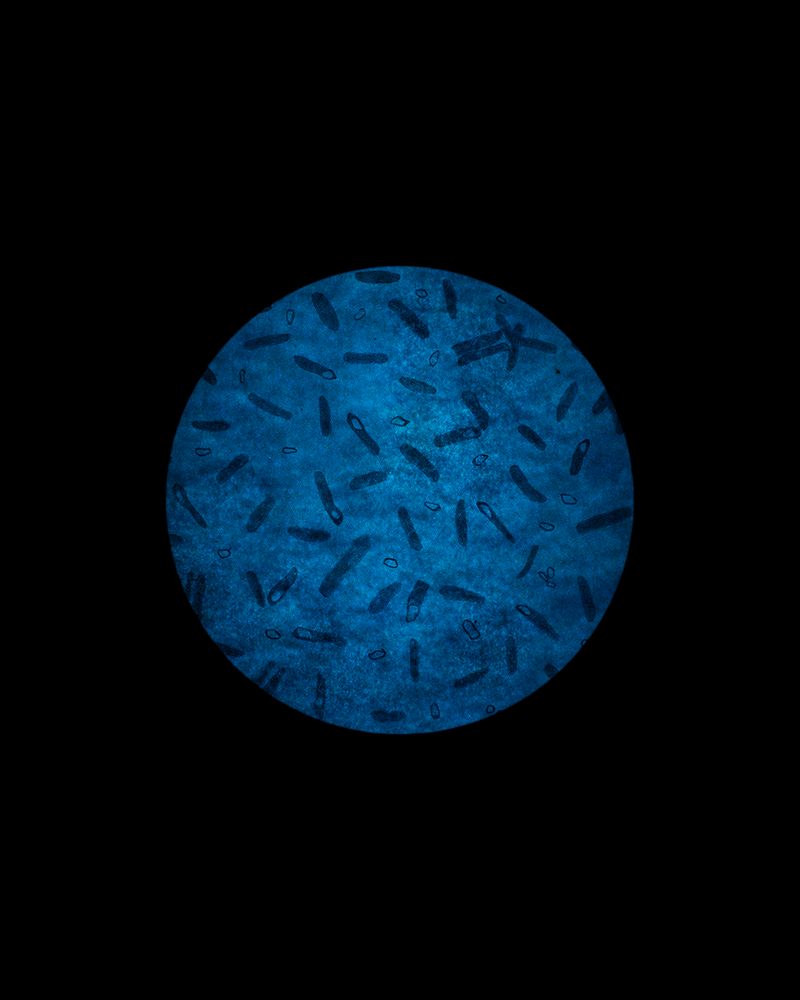 © Ellen Smeets - Image from the Happiness is a warm scalpel.  Fundamental Methods photography project