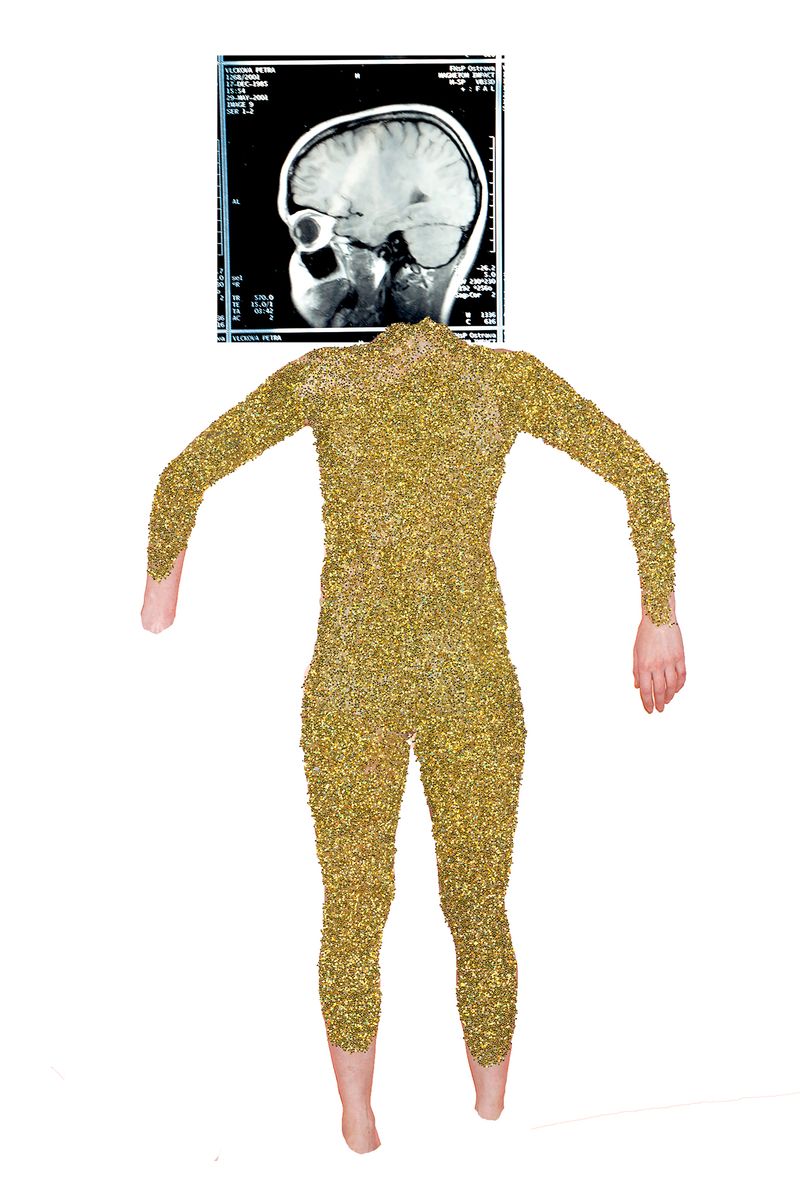 © Petra Vlčková - My interpretation of MRI scan.