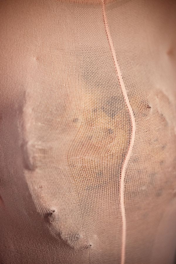 © Alexis McKeown - Fad Diet