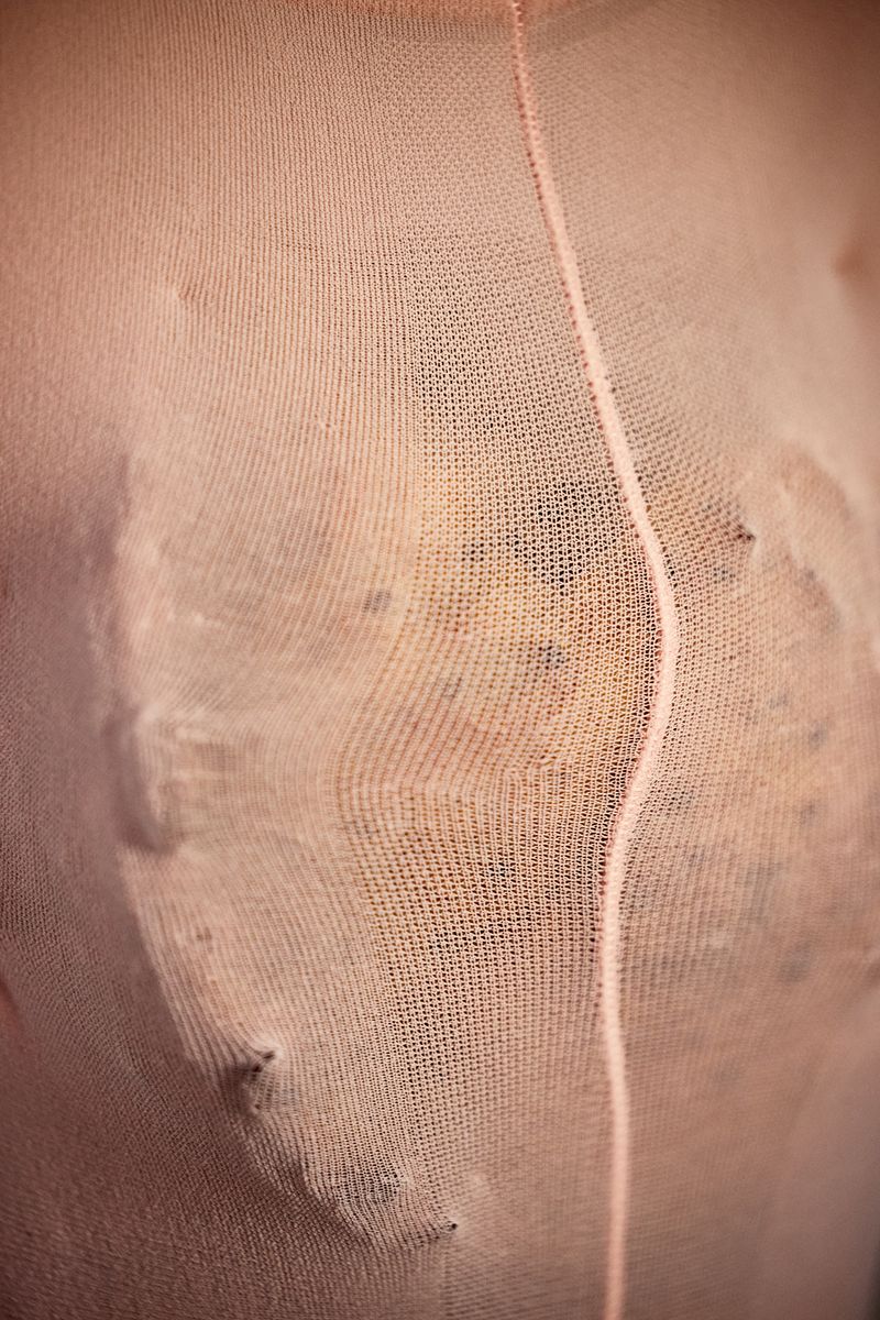 © Alexis McKeown - Fad Diet