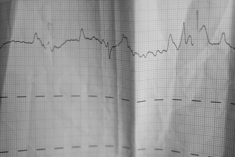 © Aga Luczakowska - The last ‘image’ of my mother – her heart’s ECG recorded by paramedics just moments before her death.