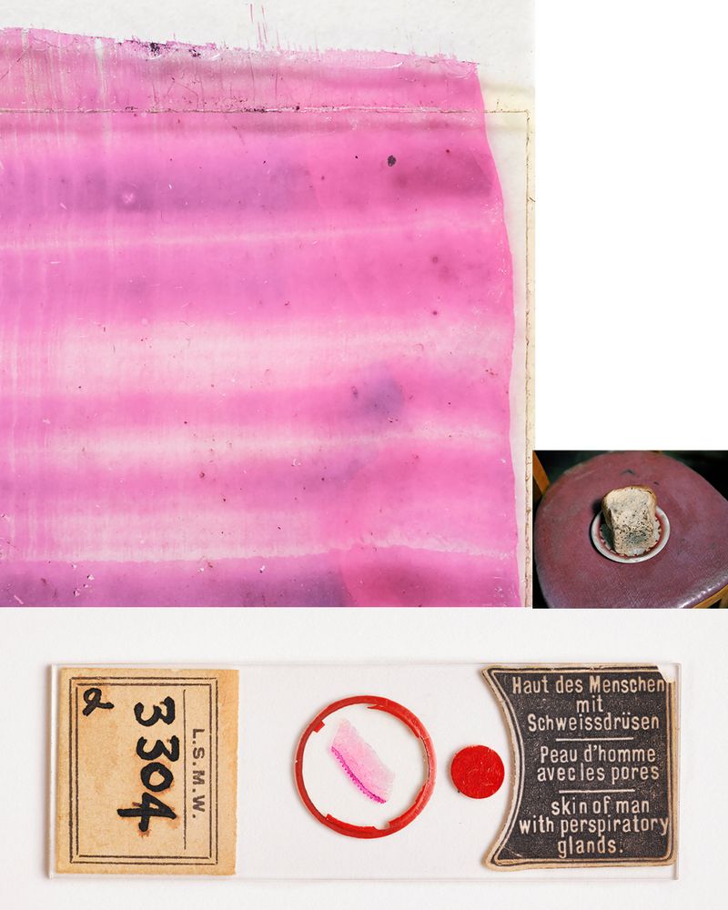 © Susan Worsham - "Blood Film", "Communion", and "Skin of Man with Perspiratory Glands"