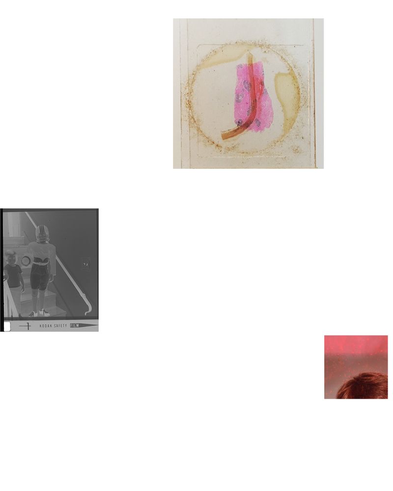 © Susan Worsham - Lactating Mammary Gland through Human Aorta/ Safety Film/ My brother's stained school headshot.