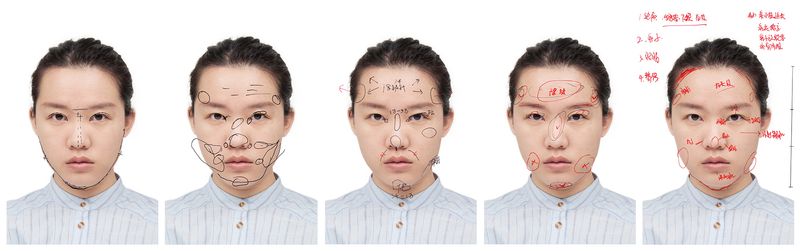 © Yufan Lu - Cosmetic surgery diagnosis 2-6