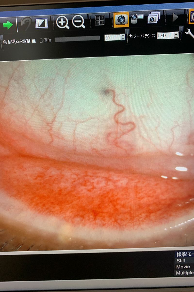 © Kenta Nakamura - My own eyeball shown to me by the doctor when I visited the ophthalmologist.