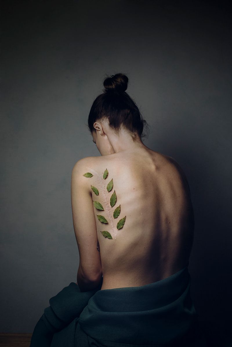 © Gery ten Broek - Image from the Vulnerable photography project